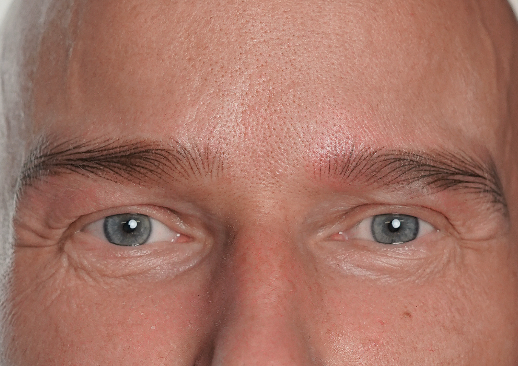 Meelis after